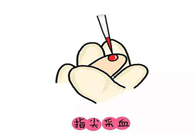 儿童榴莲视频app色版网站微量元素的检测项目有哪些 儿童榴莲视频app色版网站微量元素的检测项目有哪些