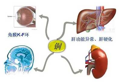 人体榴莲app破解版数据能够准检测出但身体中微量元素铜超标会引起疾病发生 人体榴莲app破解版数据能够准检测出但身体中微量元素铜超标会引起疾病发生